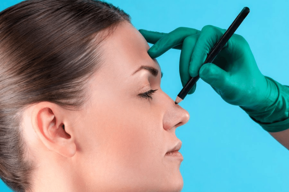 Deviasyon (Septoplasti) 